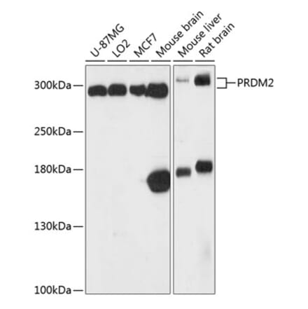 Western Blot - Anti-RIZ1 Antibody (A87560) - Antibodies.com