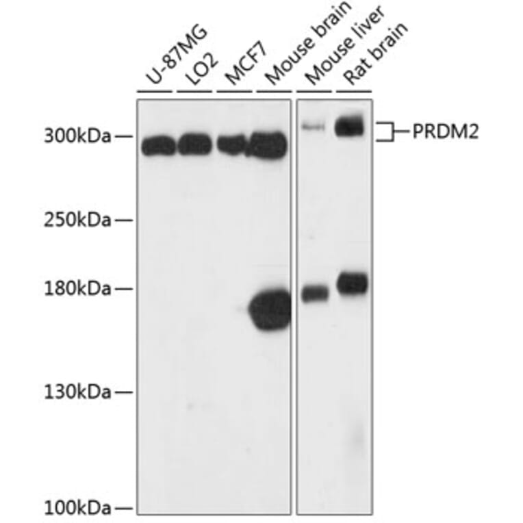 Western Blot - Anti-RIZ1 Antibody (A87560) - Antibodies.com