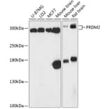 Western Blot - Anti-RIZ1 Antibody (A87560) - Antibodies.com