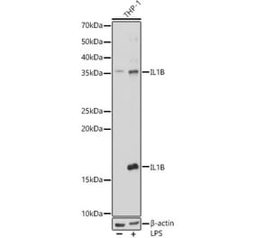 Western Blot - Anti-IL-1 beta Antibody (A87561) - Antibodies.com