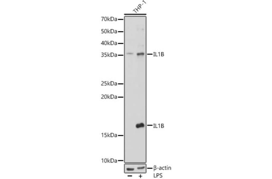 Western Blot - Anti-IL-1 beta Antibody (A87561) - Antibodies.com