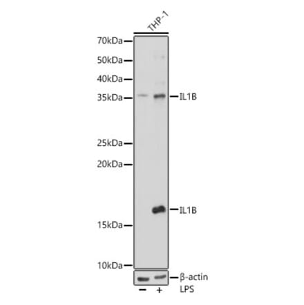 Western Blot - Anti-IL-1 beta Antibody (A87561) - Antibodies.com