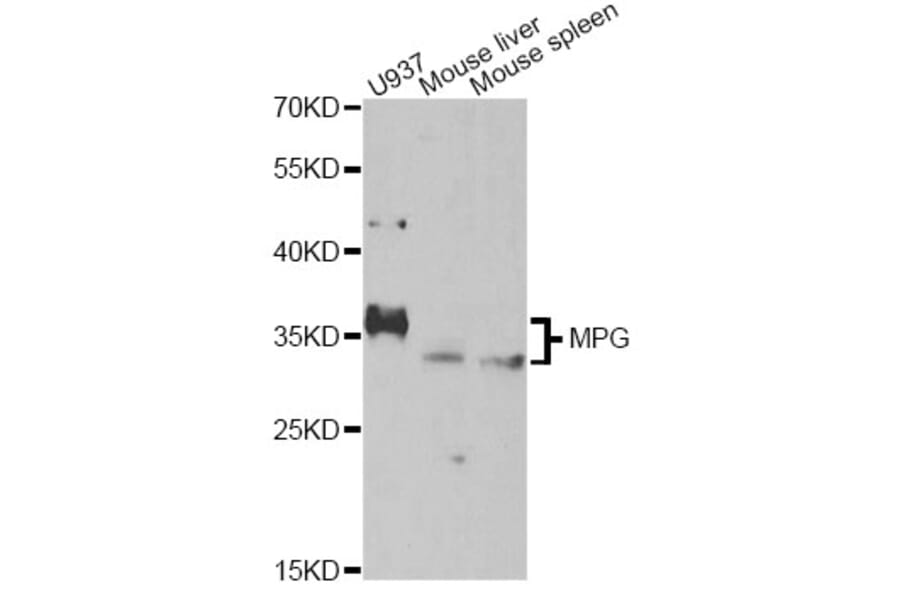 Western Blot - Anti-MPG Antibody (A14025) - Antibodies.com