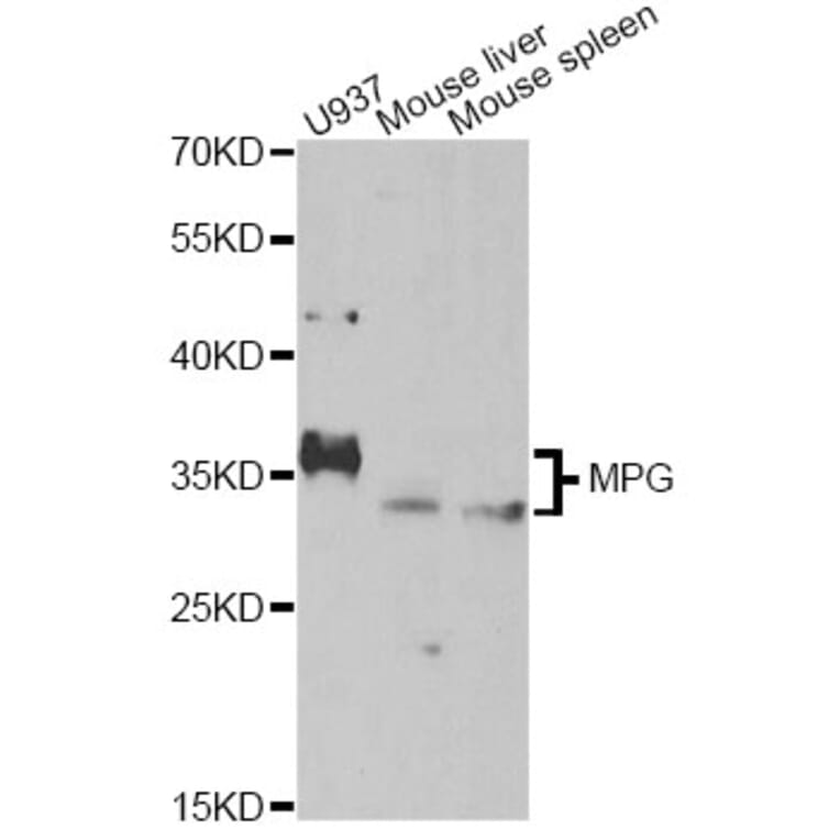Western Blot - Anti-MPG Antibody (A14025) - Antibodies.com