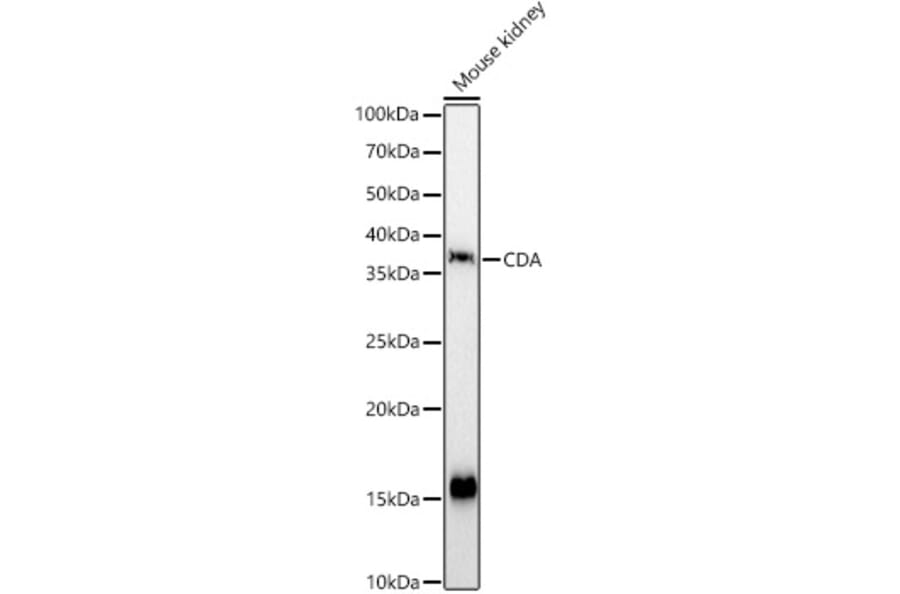 Western Blot - Anti-CDA Antibody (A87563) - Antibodies.com