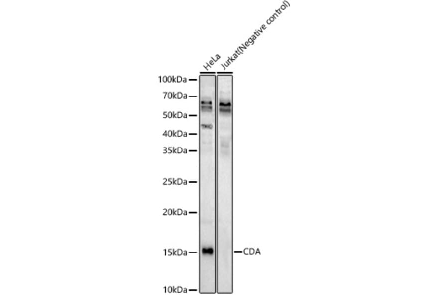 Western Blot - Anti-CDA Antibody (A87563) - Antibodies.com