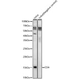 Western Blot - Anti-CDA Antibody (A87563) - Antibodies.com