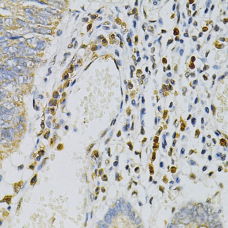 Immunohistochemistry - Anti-CDA Antibody (A87563) - Antibodies.com