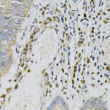 Immunohistochemistry - Anti-CDA Antibody (A87563) - Antibodies.com