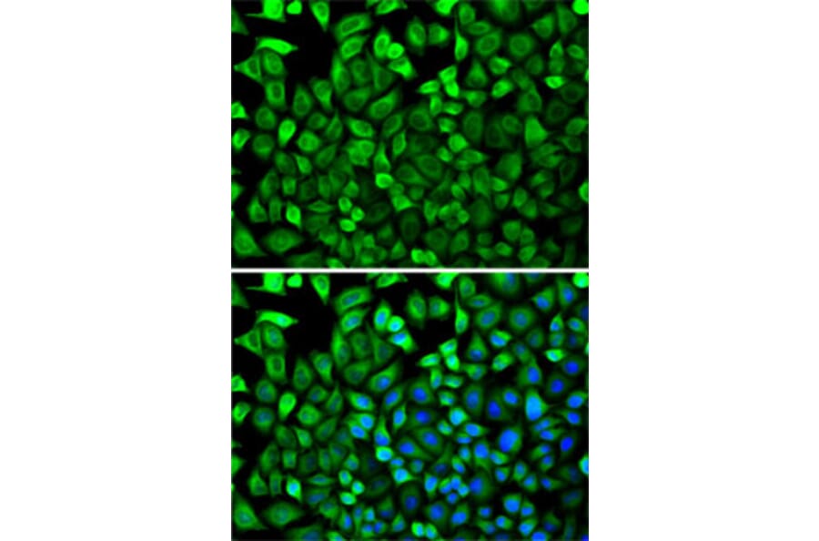 Immunofluorescence - Anti-CDA Antibody (A87563) - Antibodies.com