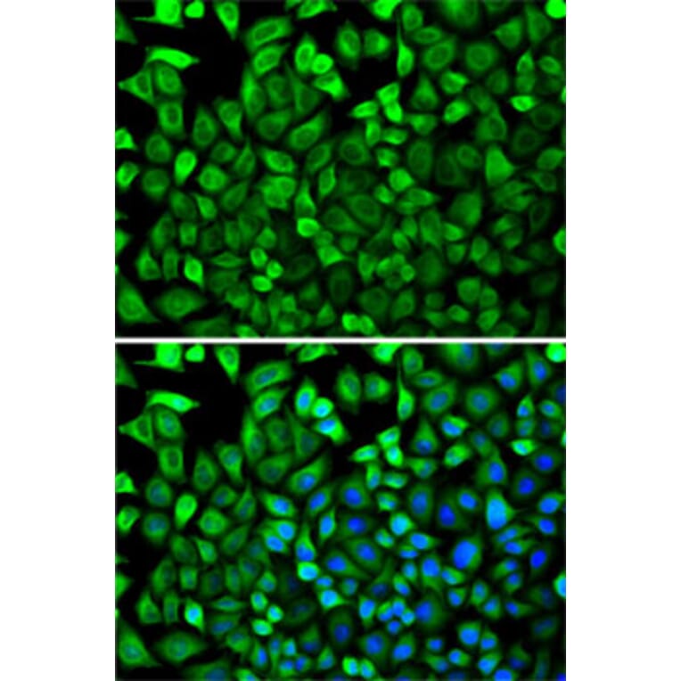 Immunofluorescence - Anti-CDA Antibody (A87563) - Antibodies.com