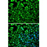 Immunofluorescence - Anti-CDA Antibody (A87563) - Antibodies.com