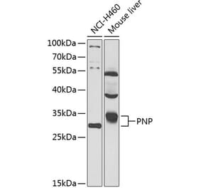 Western Blot - Anti-Nucleoside phosphorylase Antibody (A87564) - Antibodies.com