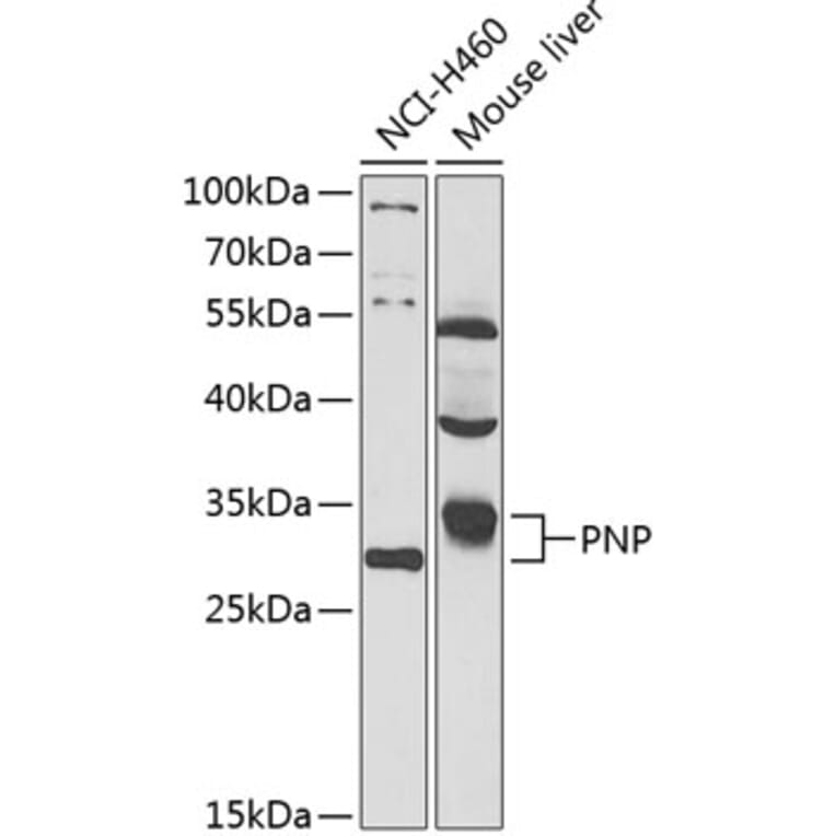 Western Blot - Anti-Nucleoside phosphorylase Antibody (A87564) - Antibodies.com