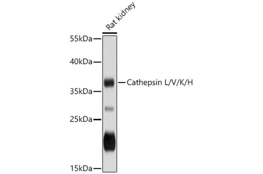 Western Blot - Anti-Cathepsin L/MEP Antibody (A87565) - Antibodies.com