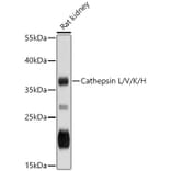 Western Blot - Anti-Cathepsin L / MEP Antibody (A87565) - Antibodies.com