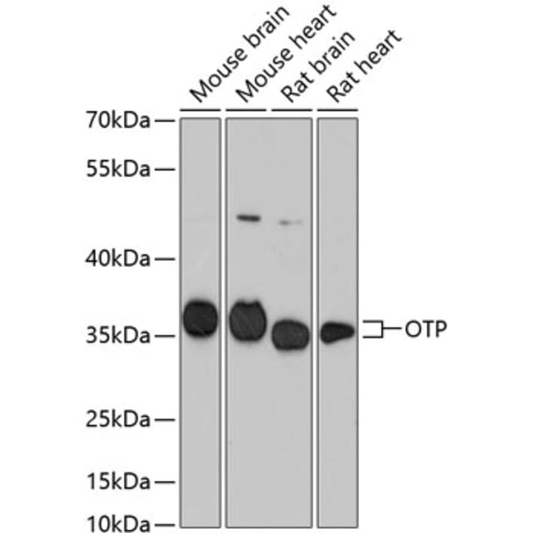 Western Blot - Anti-OTP Antibody (A87566) - Antibodies.com