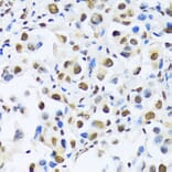 Immunohistochemistry - Anti-OTP Antibody (A87566) - Antibodies.com