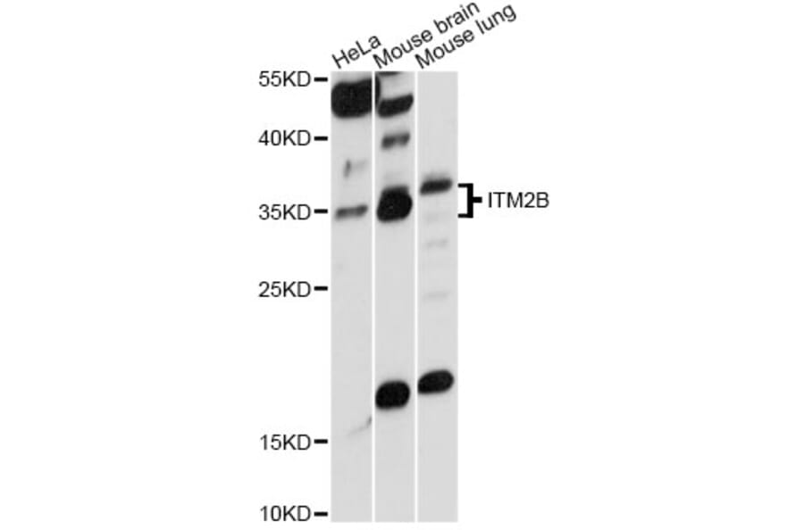 Western Blot - Anti-ITM2B Antibody (A14824) - Antibodies.com
