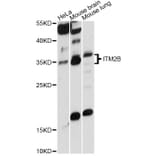 Western Blot - Anti-ITM2B Antibody (A14824) - Antibodies.com
