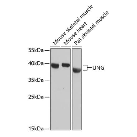 Western Blot - Anti-UNG Antibody (A87570) - Antibodies.com