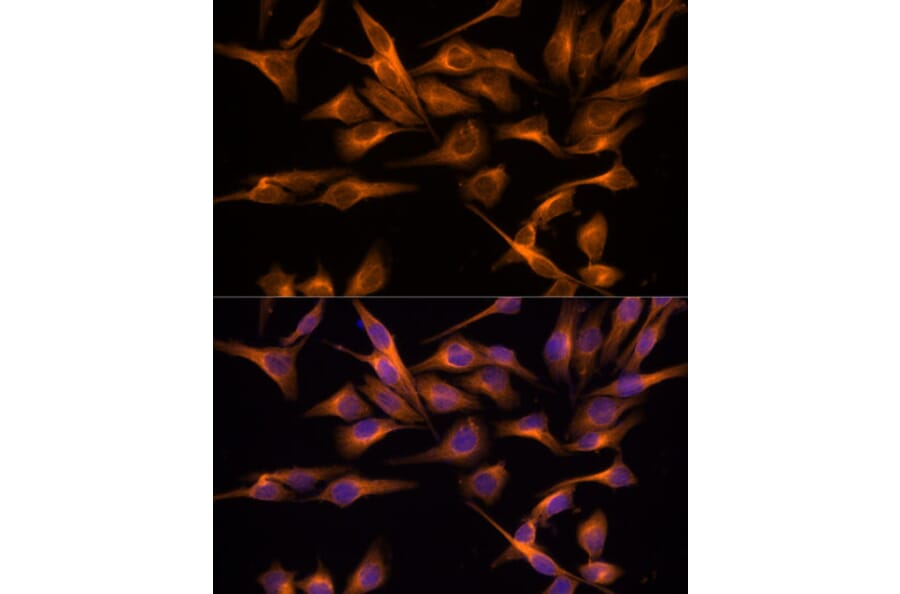 Immunofluorescence - Anti-UNG Antibody (A87570) - Antibodies.com