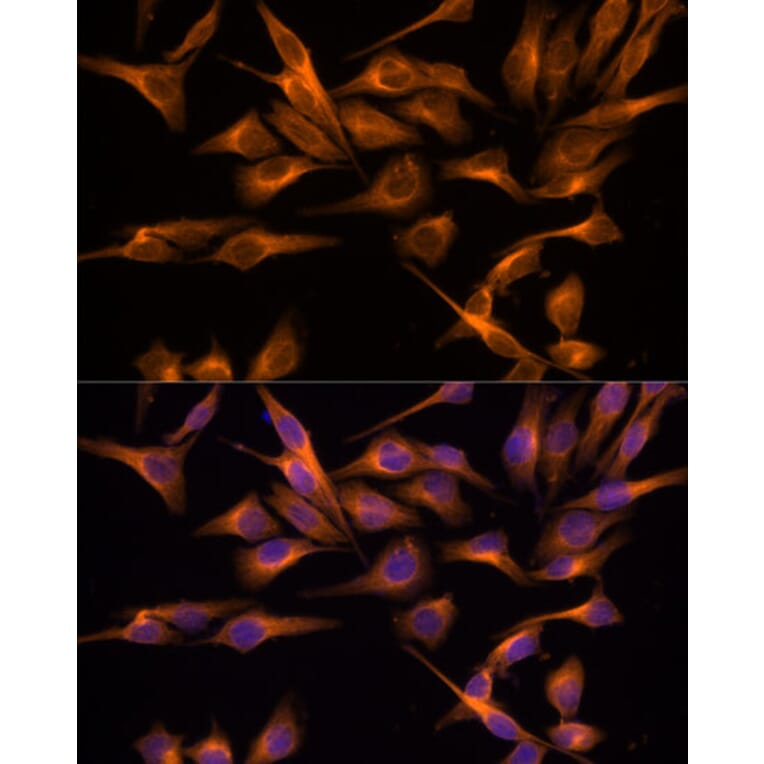 Immunofluorescence - Anti-UNG Antibody (A87570) - Antibodies.com