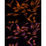 Immunofluorescence - Anti-UNG Antibody (A87570) - Antibodies.com