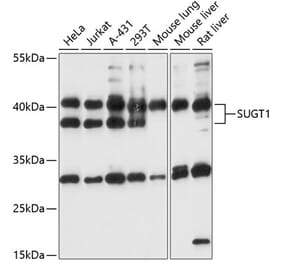 Western Blot - Anti-SUGT1 Antibody (A87571) - Antibodies.com