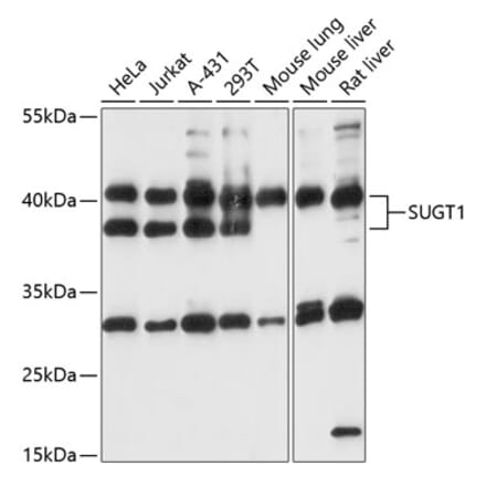 Western Blot - Anti-SUGT1 Antibody (A87571) - Antibodies.com