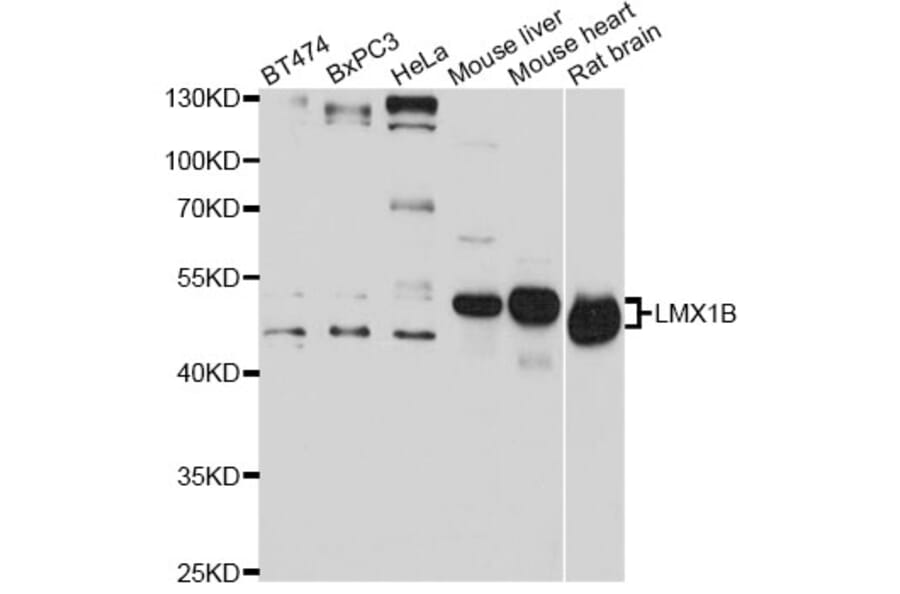 Western Blot - Anti-LMX1B Antibody (A14021) - Antibodies.com