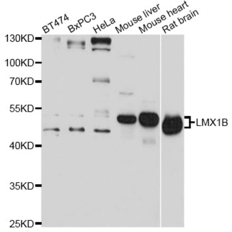 Western Blot - Anti-LMX1B Antibody (A14021) - Antibodies.com