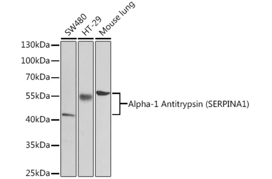 Western Blot - Anti-alpha 1 Antitrypsin Antibody (A87574) - Antibodies.com