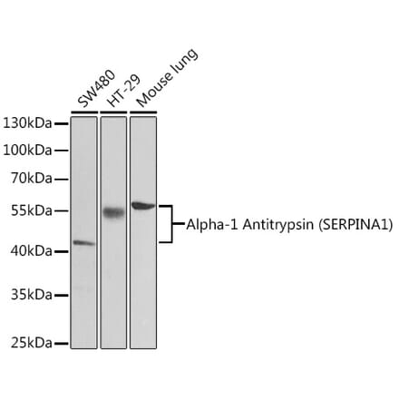Western Blot - Anti-alpha 1 Antitrypsin Antibody (A87574) - Antibodies.com