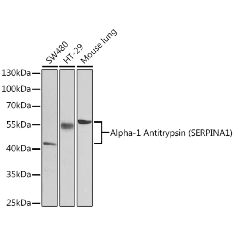 Western Blot - Anti-alpha 1 Antitrypsin Antibody (A87574) - Antibodies.com