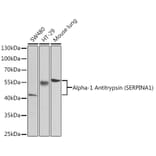 Western Blot - Anti-alpha 1 Antitrypsin Antibody (A87574) - Antibodies.com