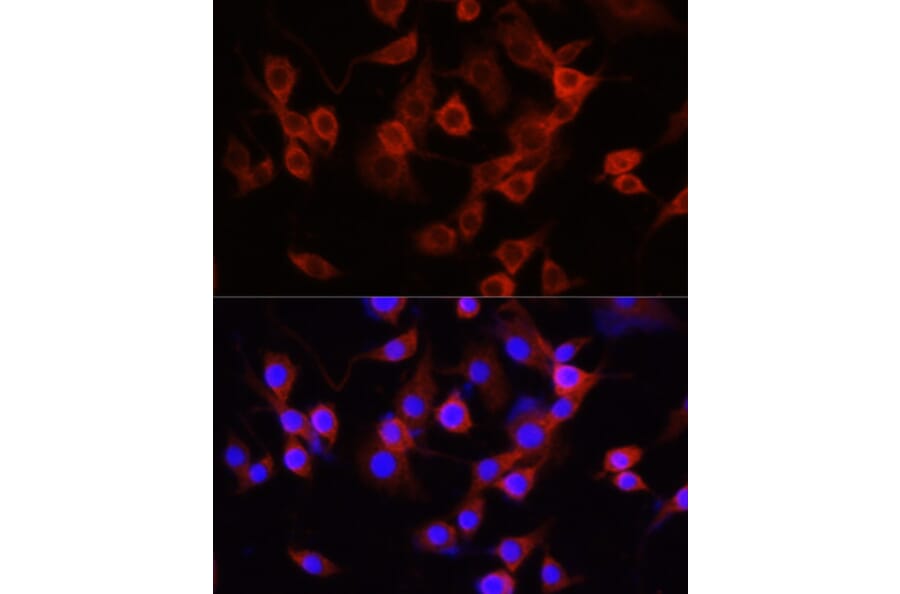 Immunofluorescence - Anti-alpha 1 Antitrypsin Antibody (A87574) - Antibodies.com