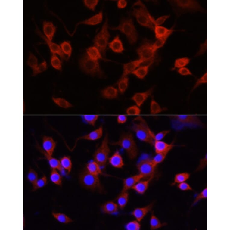 Immunofluorescence - Anti-alpha 1 Antitrypsin Antibody (A87574) - Antibodies.com