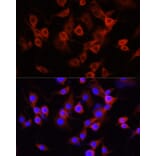 Immunofluorescence - Anti-alpha 1 Antitrypsin Antibody (A87574) - Antibodies.com