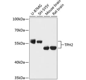 Western Blot - Anti-TPH2 Antibody (A87575) - Antibodies.com