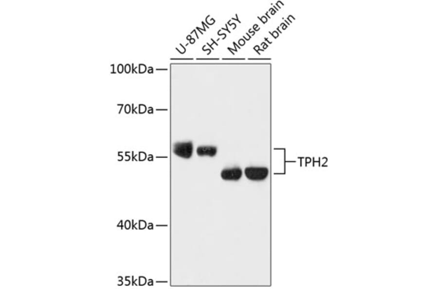 Western Blot - Anti-TPH2 Antibody (A87575) - Antibodies.com