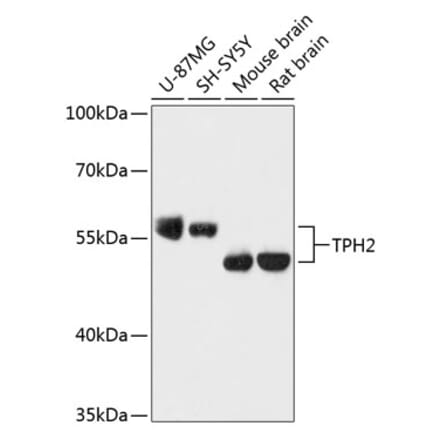 Western Blot - Anti-TPH2 Antibody (A87575) - Antibodies.com