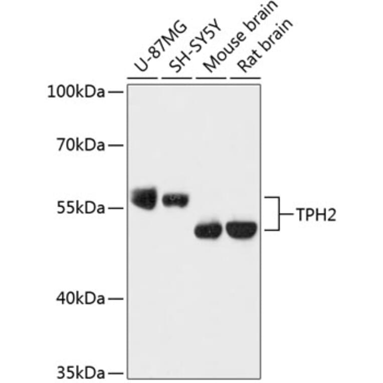 Western Blot - Anti-TPH2 Antibody (A87575) - Antibodies.com