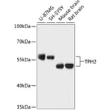 Western Blot - Anti-TPH2 Antibody (A87575) - Antibodies.com