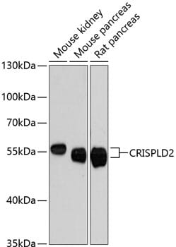 Western blot analysis of extracts of various cell lines, using Anti-CRISPLD2 Antibody (A13195) at 1:3000 dilution.
Secondary antibody: Goat Anti-Rabbit IgG (H+L) (HRP) (AS014) at 1:10,000 dilution.
Lysates / proteins: 25µg per lane.
Blocking buffer: 3% non-fat dry milk in TBST.
Detection: ECL Enhanced Kit (RM00021).
Exposure time: 90s.