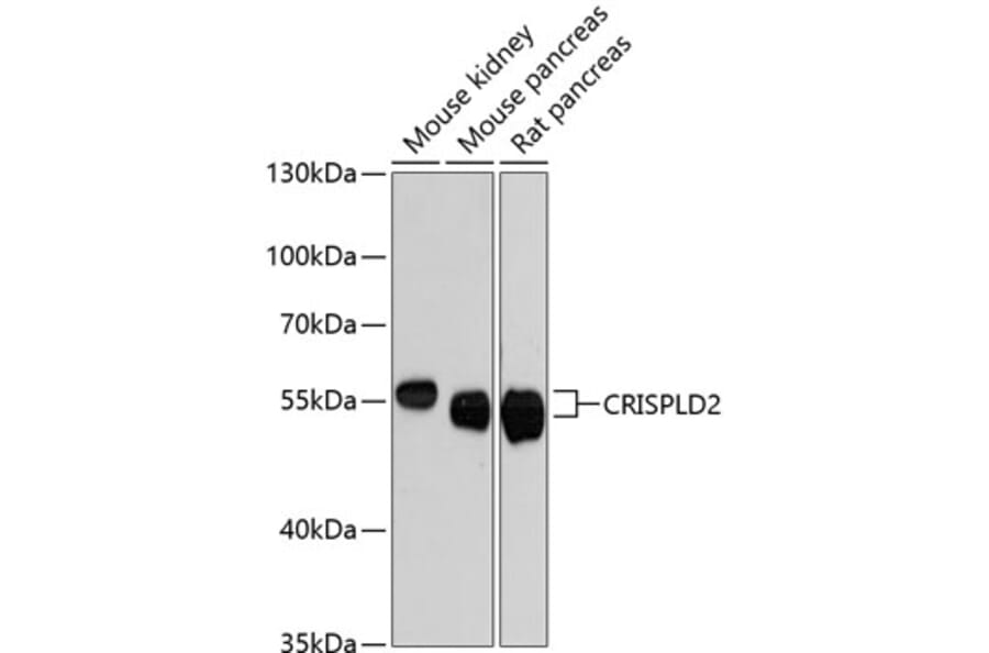 Western Blot - Anti-CRISPLD2 Antibody (A87576) - Antibodies.com