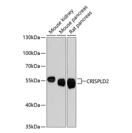Western Blot - Anti-CRISPLD2 Antibody (A87576) - Antibodies.com