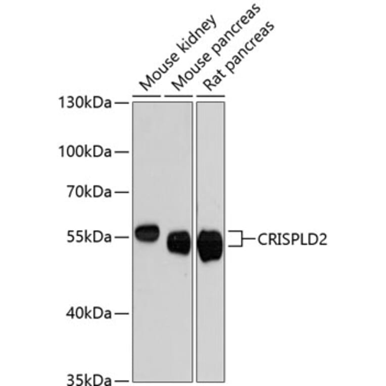 Western Blot - Anti-CRISPLD2 Antibody (A87576) - Antibodies.com