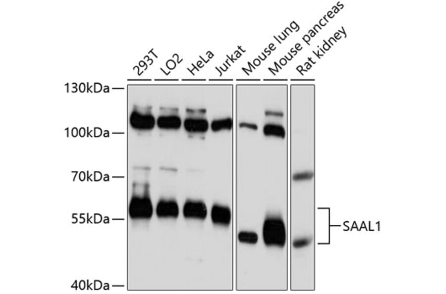 Western Blot - Anti-SAAL1 Antibody (A87577) - Antibodies.com
