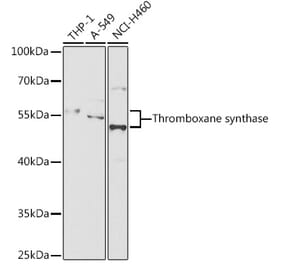 Western Blot - Anti-Thromboxane synthase Antibody (A87578) - Antibodies.com